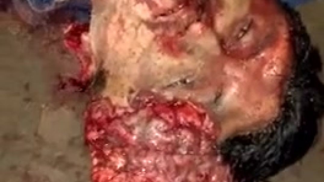 brutal accidente en motocicleta