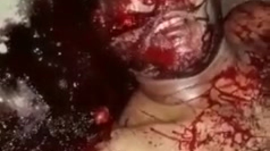 Un tipo tiene un accidente